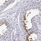 Immunohistochemical staining of human testis shows high expression.