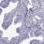 Immunohistochemical staining of human fallopian tube shows low expression as expected.