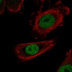 Anti-ZHX1 Antibody