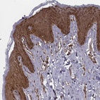 Anti-RPL3 Antibody