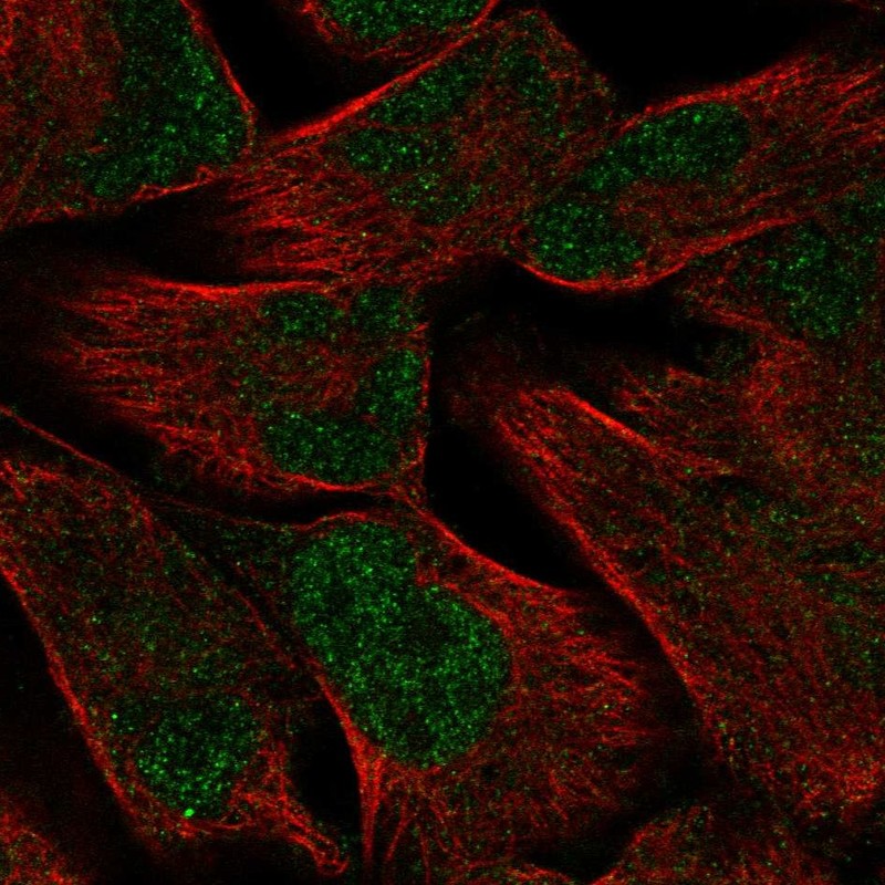 Anti-PKNOX2 Antibody