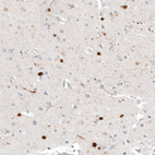 Anti-CALB2 Antibody