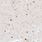 Immunohistochemical staining of human cerebral cortex shows strong cytoplasmic positivity in a subset of neurons.