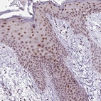 Immunohistochemical staining of human skin shows moderate nuclear positivity in squamous epithelial cells.