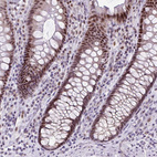 Anti-CLK2 Antibody