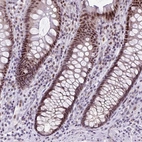 Immunohistochemical staining of human colon shows moderate to strong nuclear positivity in glandular cells.