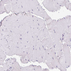 Immunohistochemical staining of human skeletal muscle shows no positivity in myocytes as expected.