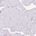 Immunohistochemical staining of human skeletal muscle shows no positivity in myocytes as expected.