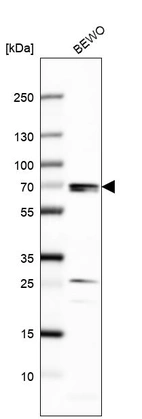 Western blot analysis in human cell line BEWO.