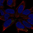 Anti-DCC Antibody