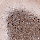 Immunohistochemical staining of human cerebellum shows strong cytoplasmic positivity in cells in granular layer.