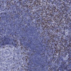 Immunohistochemical staining of human tonsil shows high expression.