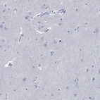 Anti-PYHIN1 Antibody