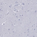Immunohistochemical staining of human cerebral cortex shows low expression as expected.