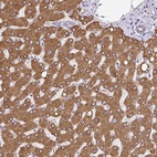 Anti-EML5 Antibody