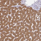 Anti-EML5 Antibody