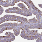 Immunohistochemical staining of human Fallopian tube shows moderate granular cytoplasmic positivity in glandular cells.