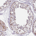 Immunohistochemical staining of human testis shows moderate granular cytoplasmic positivity in cells in seminiferous ducts.