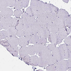 Immunohistochemical staining of human skeletal muscle shows no positivity in myocytes as expected.