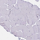 Immunohistochemical staining of human skeletal muscle shows no positivity in myocytes as expected.