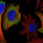 Immunofluorescent staining of human cell line HeLa shows localization to cytosol.