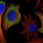 Immunofluorescent staining of human cell line HeLa shows localization to cytosol.