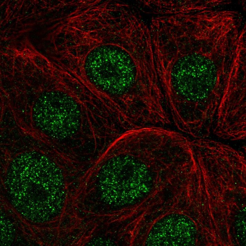 Anti-IER2 Antibody