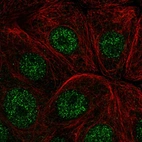 Anti-IER2 Antibody