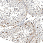 Anti-CALB2 Antibody