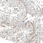 Immunohistochemical staining of human testis shows moderate cytoplasmic positivity in cells in seminiferous ducts.