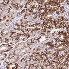 Anti-ZNF256 Antibody