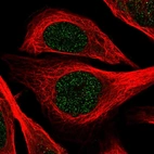 Immunofluorescent staining of human cell line U-2 OS shows localization to nucleoplasm.
