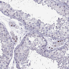 Anti-C16orf59 Antibody