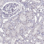 Anti-C16orf59 Antibody