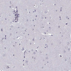 Immunohistochemical staining of human cerebral cortex shows no positivity in neurons as expected.