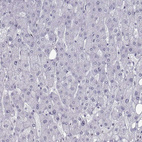 Immunohistochemical staining of human liver shows no positivity in hepatocytes as expected.