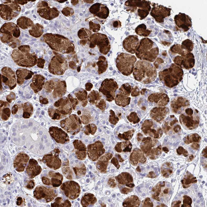 Anti-ZNF214 Antibody