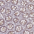 Immunohistochemical staining of human rectum shows weak cytoplasmic positivity in glandular cells.