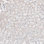 Immunohistochemical staining of human liver shows no positivity in hepatocytes as expected.