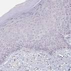 Immunohistochemical staining of human skin shows no positivity in squamous epithelial cells as expected.