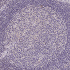 Immunohistochemical staining of human lymph node shows no positivity in germinal center cells as expected.