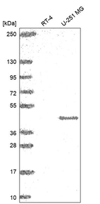Western blot analysis in human cell line RT-4 and human cell line U-251 MG.