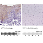 Anti-UPP1 Antibody