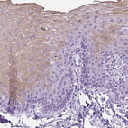 Immunohistochemical staining of human esophagus shows moderate cytoplasmic positivity in squamous epithelial cells.