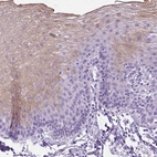 Immunohistochemical staining of human esophagus shows moderate cytoplasmic positivity in squamous epithelial cells.