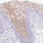 Immunohistochemical staining of human oral mucosa shows moderate cytoplasmic and membranous positivity in squamous epithelial cells.