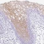 Immunohistochemical staining of human oral mucosa shows moderate cytoplasmic and membranous positivity in squamous epithelial cells.