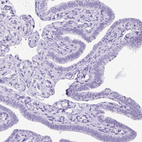 Immunohistochemical staining of human fallopian tube shows no positivity in glandular cells as expected.