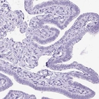 Immunohistochemical staining of human fallopian tube shows no positivity in glandular cells as expected.