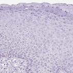 Immunohistochemical staining of human skin shows no positivity in squamous epithelial cells as expected.